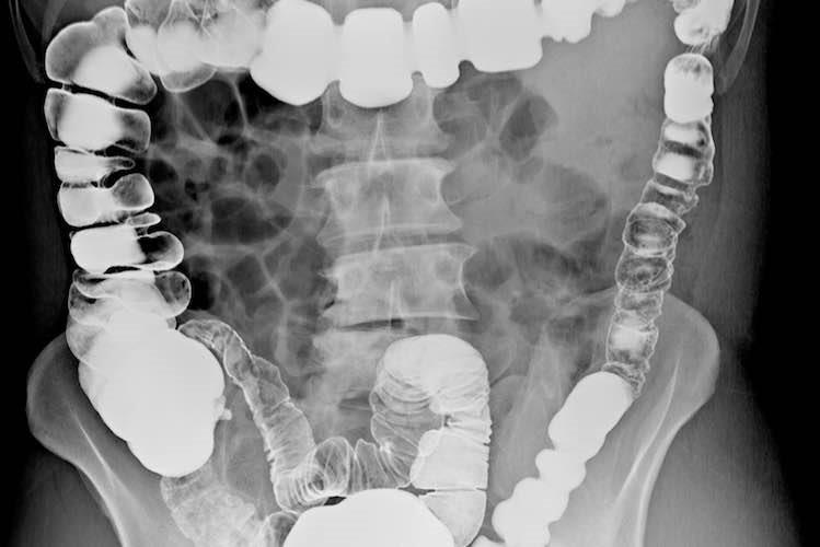 Fluoroscopy University Diagnostic Medical Imaging