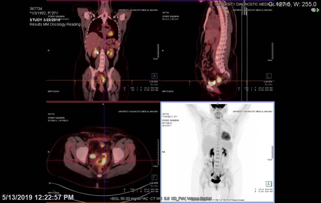 Oncologic Molecular Imaging University Diagnostic Medical Imaging