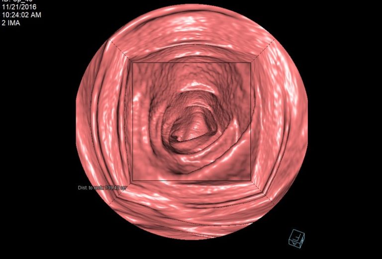 64Slice Computed Tomography (CT) University Diagnostic Medical Imaging