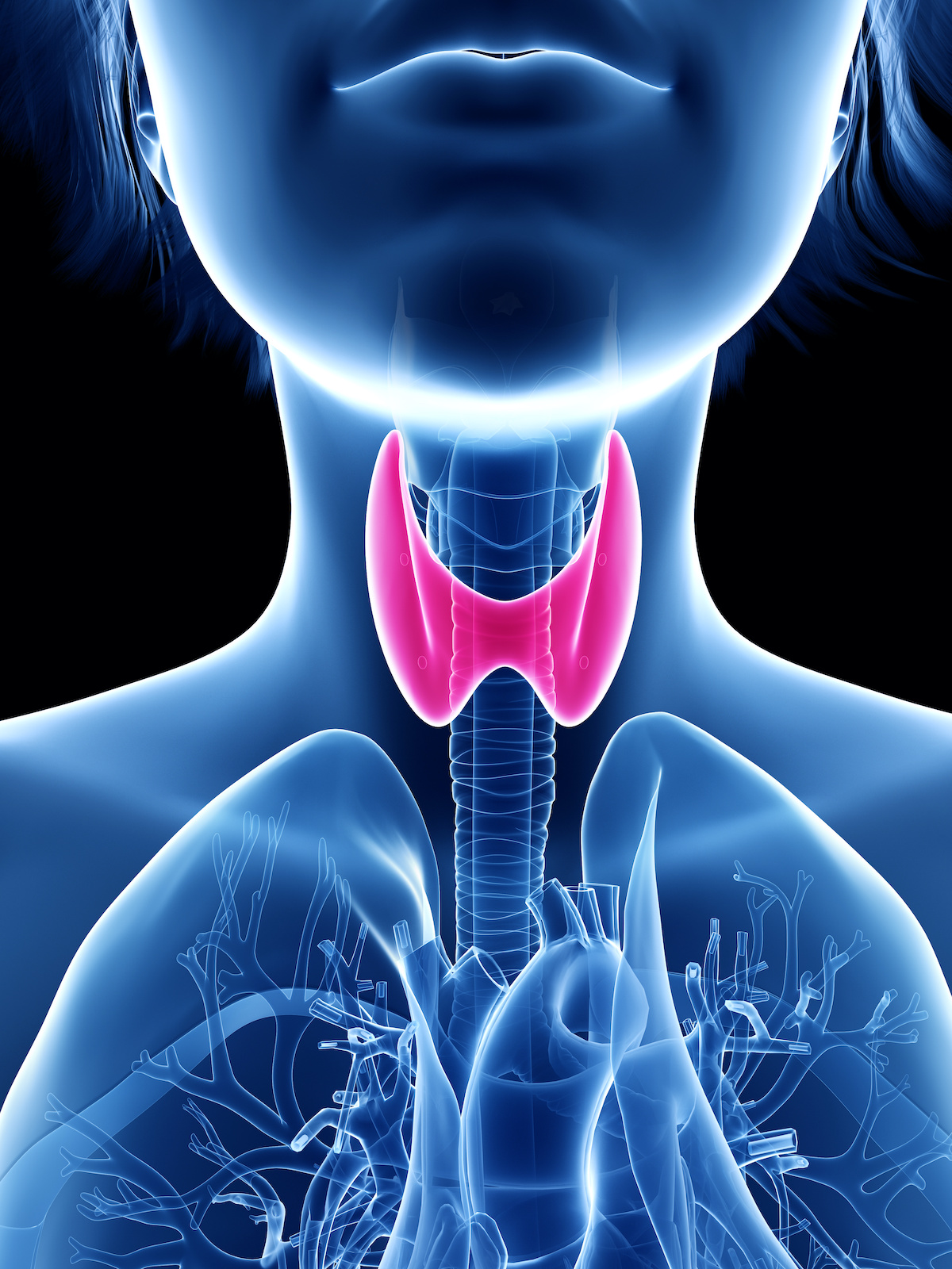 3d rendered medically accurate illustration of a womans thyroid gland; blog: How is Thyroid Disease Managed?