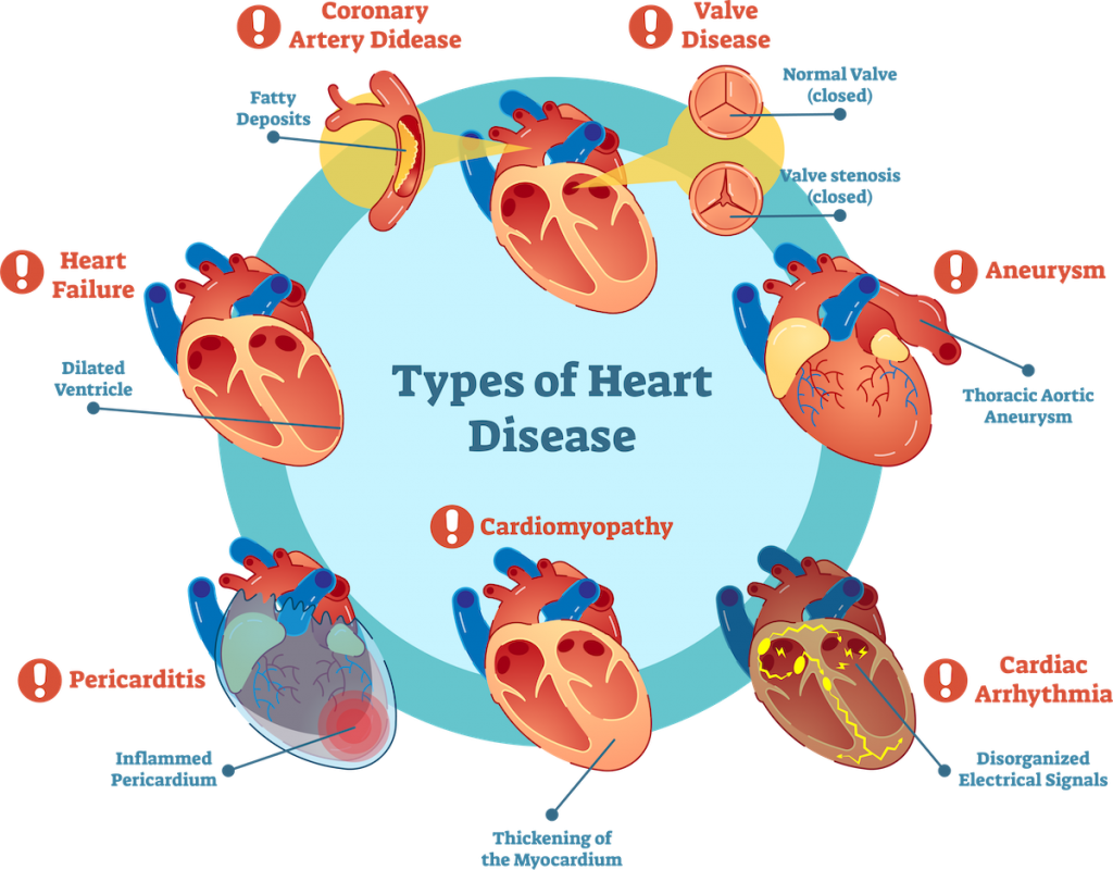 presentation of heart disease